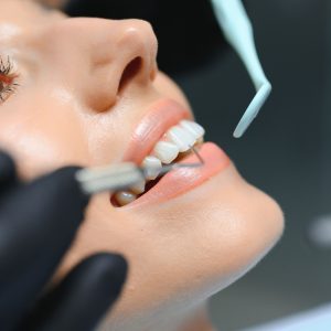 A dentist performs a dental cleaning