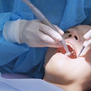 a person undergoing a dental cleaning done by a dental hygienist