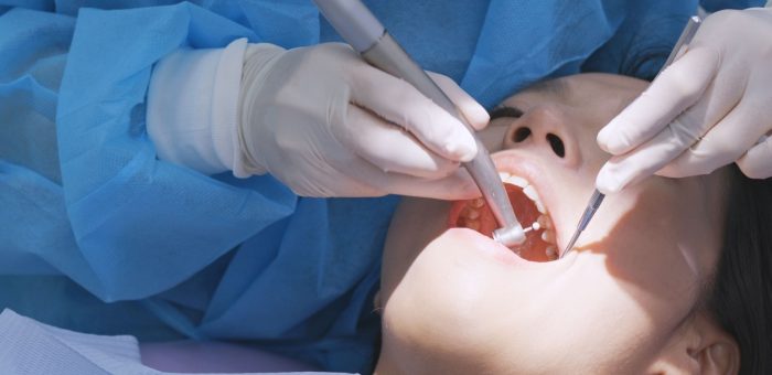 a person undergoing a dental cleaning done by a dental hygienist
